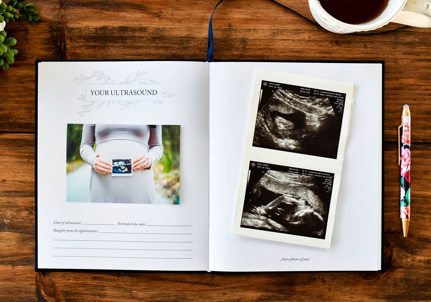 Dear Baby: A Pregnancy Prayer Journal & Memory Book for Moms: Ivory